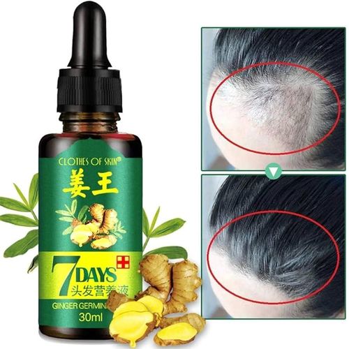 Aichun 7 Days Hair Growth Oil ā Ginger & Herbal Tonic for Hair Regrowth & Anti-Hair Loss