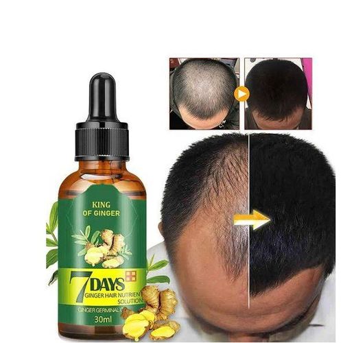 Aichun 7 Days Hair Growth Oil ā Ginger & Herbal Tonic for Hair Regrowth & Anti-Hair Loss