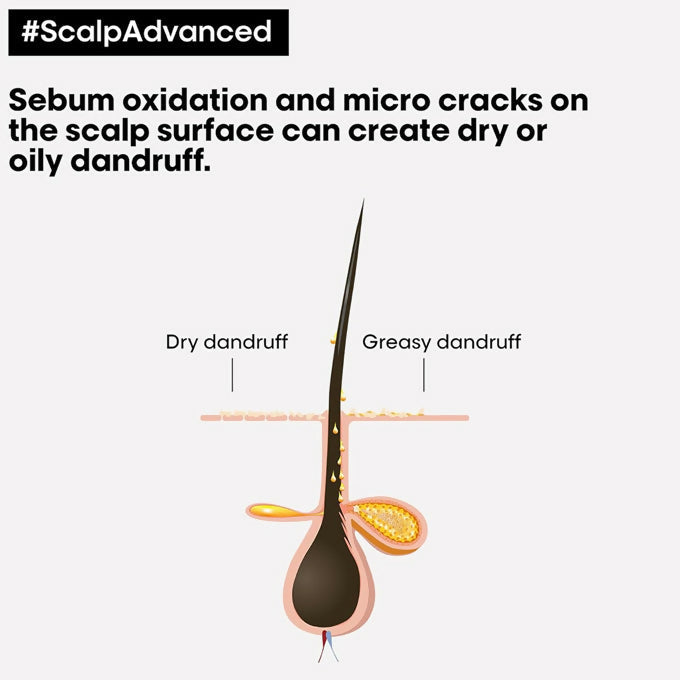 L'Oréal Professionnel Scalp Advanced Anti-Dandruff Dermo-Clarifier Shampoo 300ml