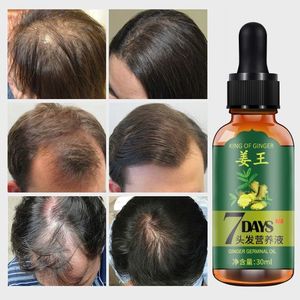 Aichun 7 Days Hair Growth Oil ā Ginger & Herbal Tonic for Hair Regrowth & Anti-Hair Loss