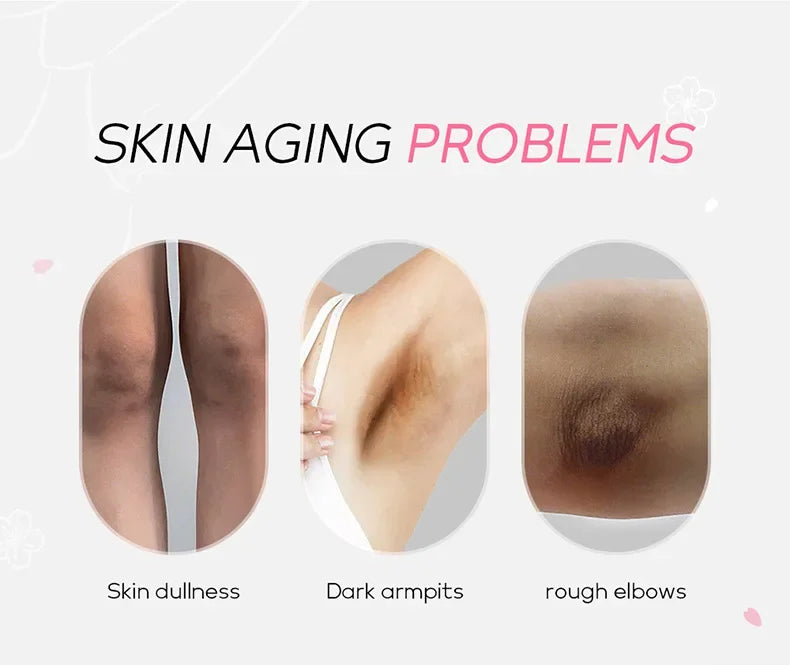 Laikou Sakura Body Whitening Lotion Dark Spot Remover For Underarms Knees Elbows Melanin Bleaching Lightening Cream 30g