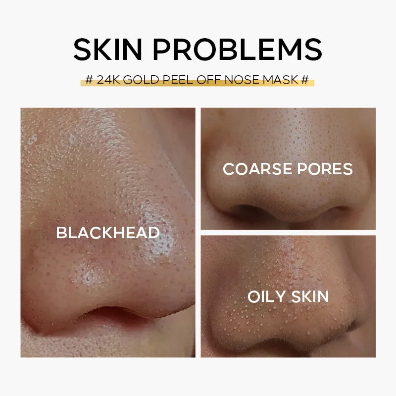 24K Gold Blackhead Remove Mask Peel Nasal Strips Deep Cleansing Shrink Pore Nose Black Head Remove Even Skin Tone 30g