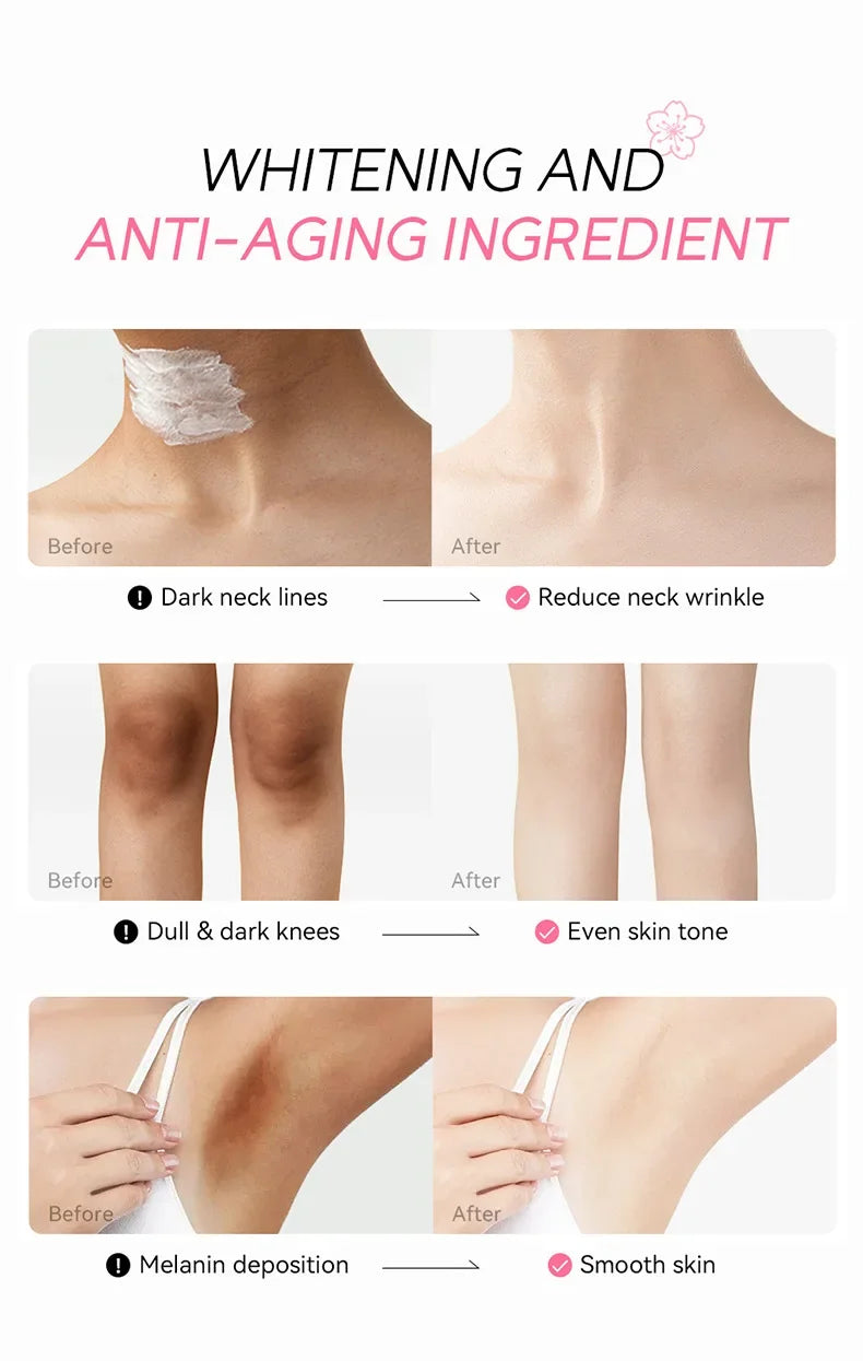 Laikou Sakura Body Whitening Lotion Dark Spot Remover For Underarms Knees Elbows Melanin Bleaching Lightening Cream 30g