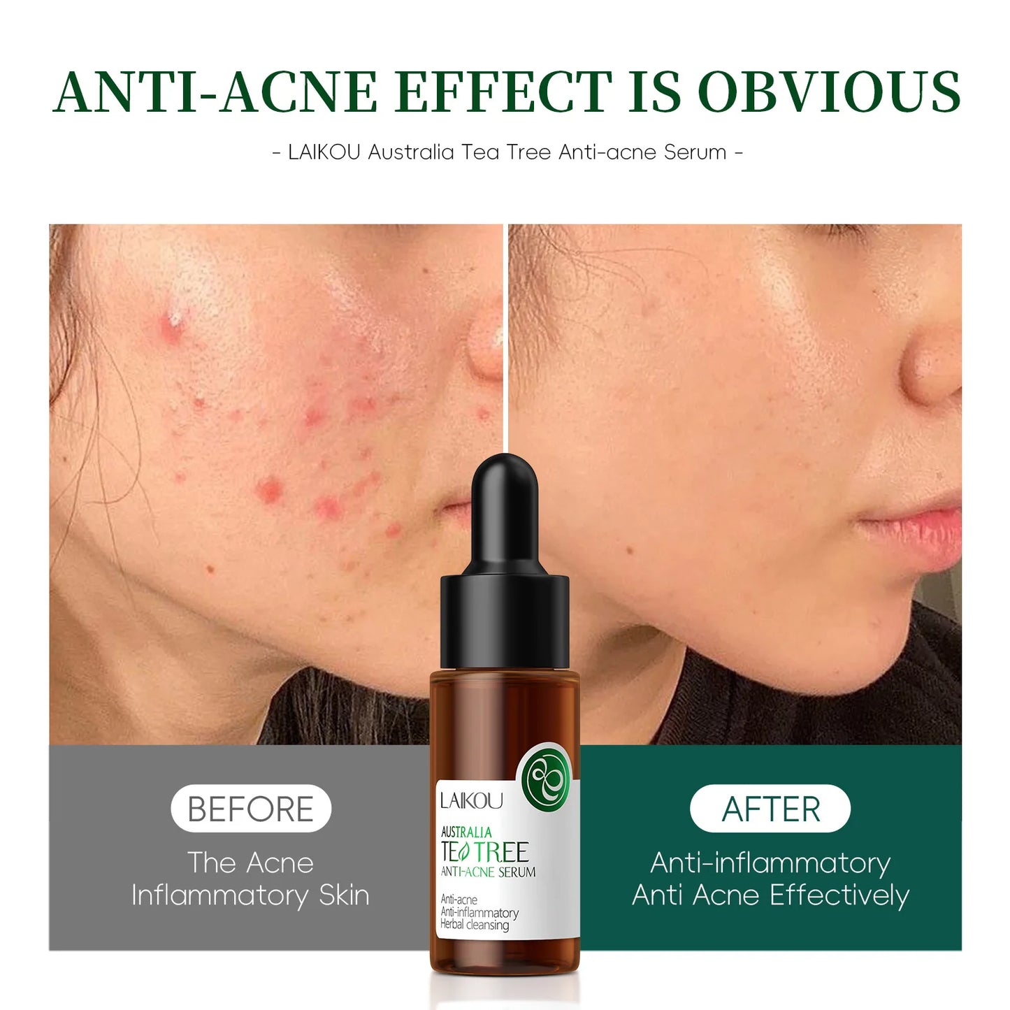 Laikou Tea Facial Essence Contains Hyaluronic Acid Dark Spot Remover Moisturizing Repair Anti-aging Essence Facial Skin Care
