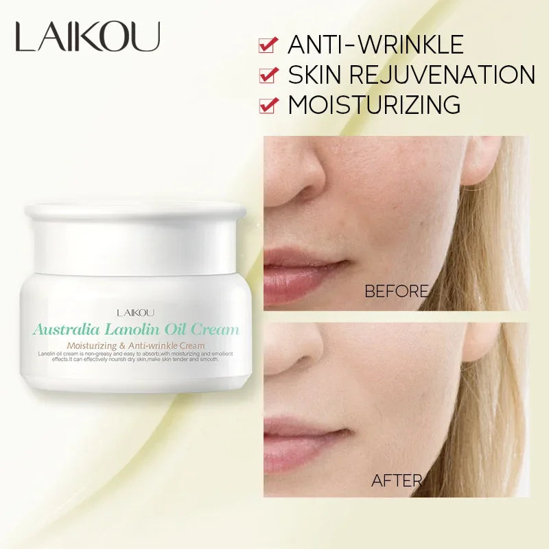 LAIKOU Australian Lanolin Oil Cream Moisturizing Nourishing Oil Controlling Skincare Face Cream, Making Skin Smooth and Elastic