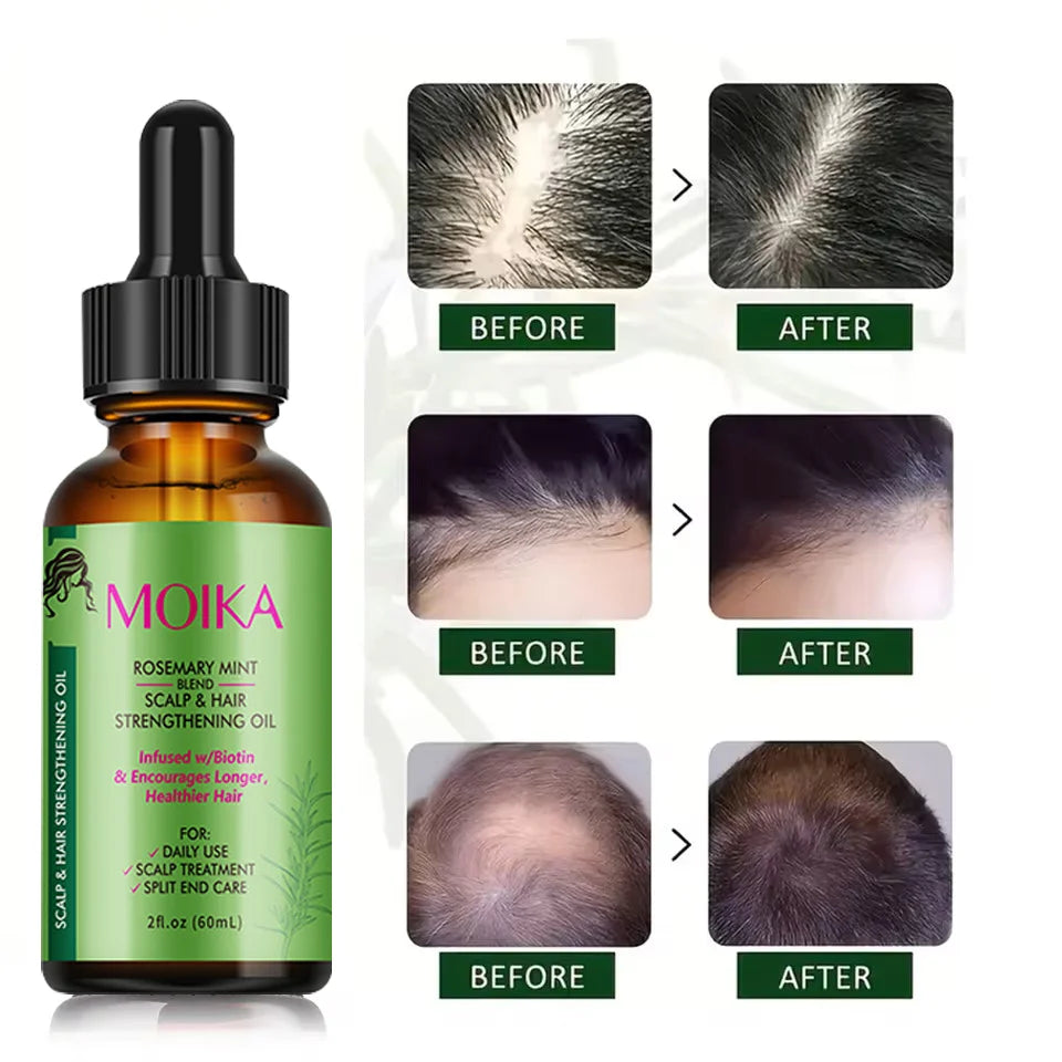 Rosemary Peppermint Hair Care Essential Oil, Prevents Dry and Split Hair, Gently Nourishes Hair Care Essential Oil