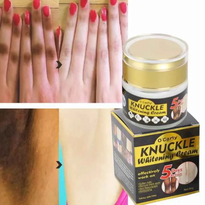 O'Carly Knuckle Whitening Cream.