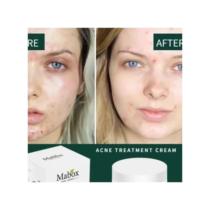 Plant Essence Acne Treatment & Moisturizing Cream