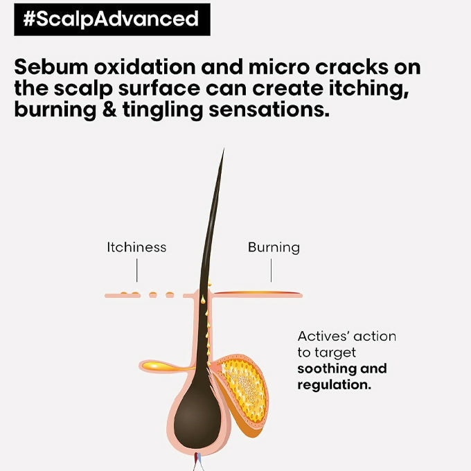 L'Oréal Professionnel Serié Expert Scalp Advanced Anti-Discomfort Hair Treatment -200ml