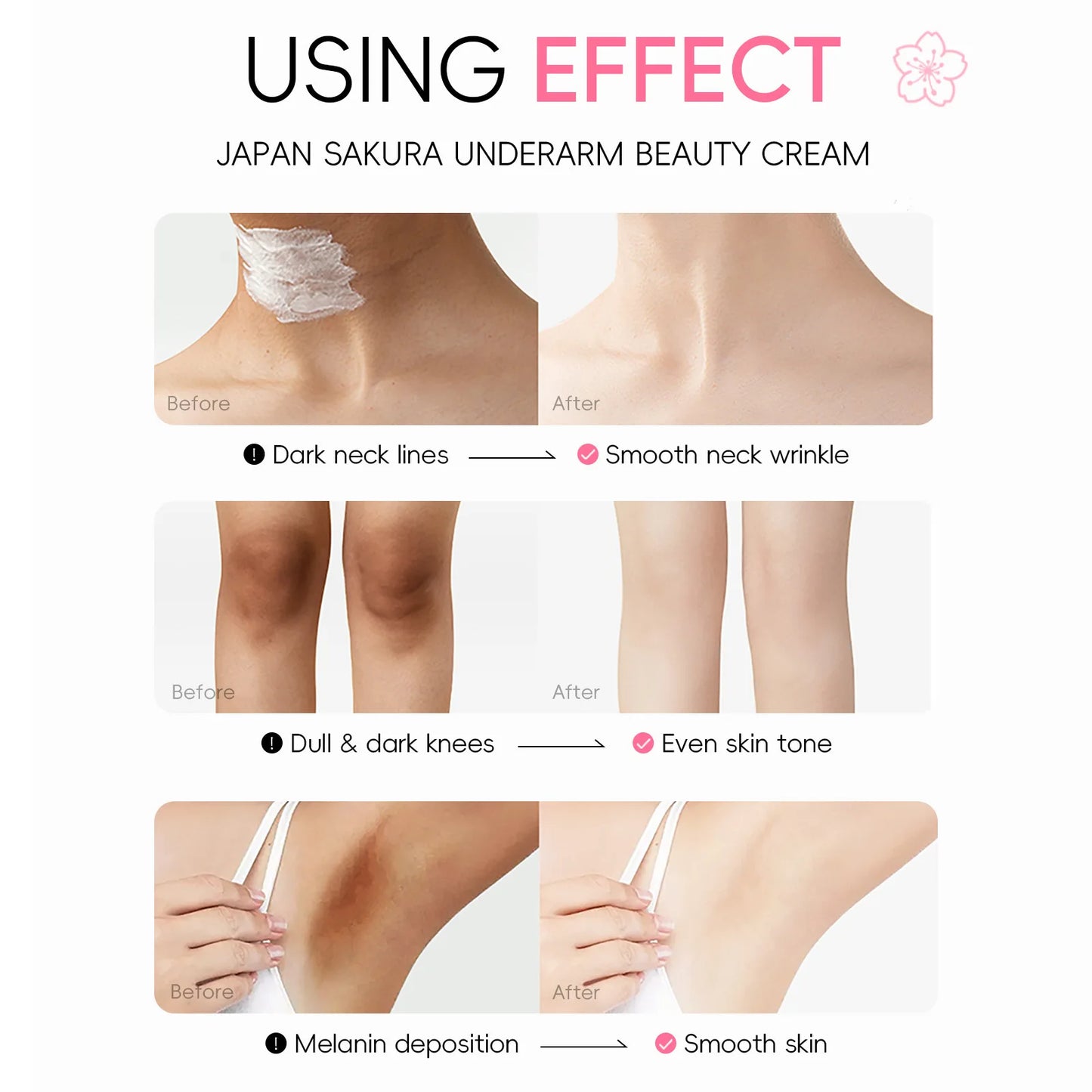 Laikou Sakura Body Whitening Lotion Dark Spot Remover For Underarms Knees Elbows Melanin Bleaching Lightening Cream 30g