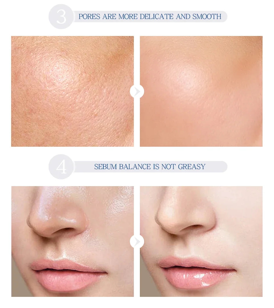 LAIKOU Hyaluronic Acid  Face Serum Anti Aging Facial Lifting Collagen Essence Skin Care Whitening Serum 17ml