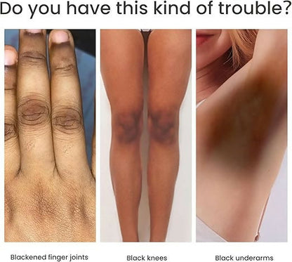 Knuckle Whitening Cream Clears Dark Knuckles & Spots- 50ML