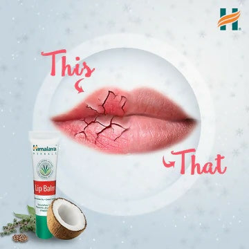 LipBalm2_360x_42bd1069-9dab-4903-b527-90aef55fc2b1_800x800