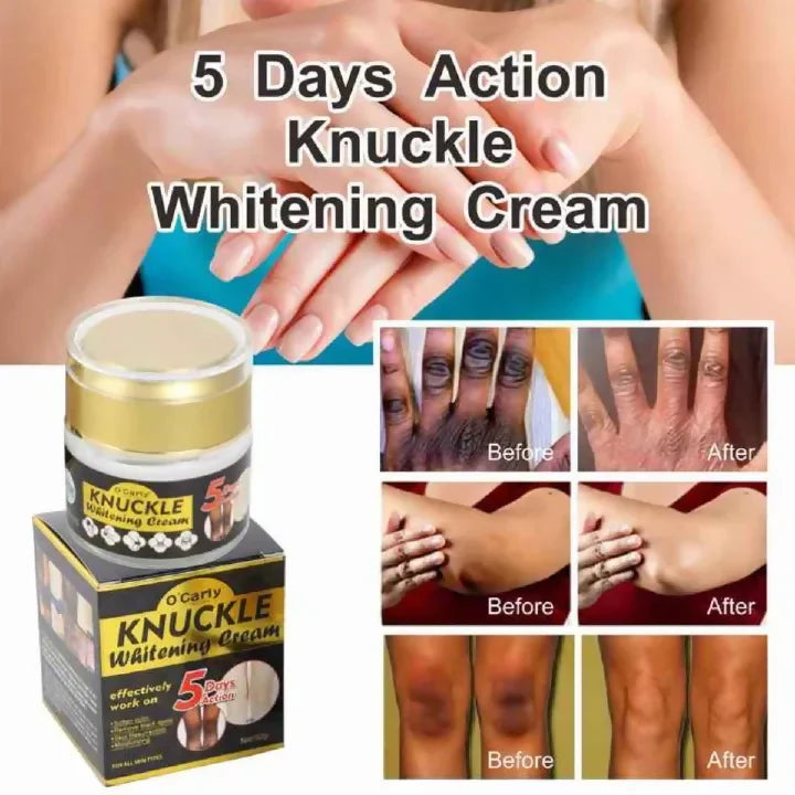 O'Carly Knuckle Whitening Cream.